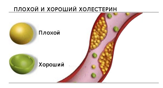 Анализ на спектр холестерина