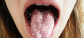 Соленый привкус во рту: причины появления, лечение и профилактика