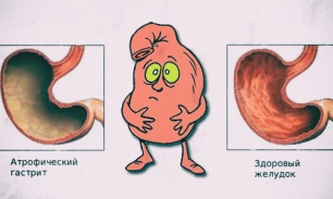 Диета при атрофическом гастрите