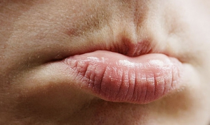 Белые точки на губах – причины появления и лечение