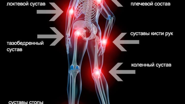 Психосоматика болезней суставов. Психосоматика суставы. Психосоматика больных суставов. Ревматоидный артрит психосоматика. Тазобедренный сустав психосоматика.