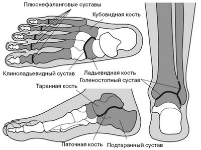 Ушиб голеностопа на футболе