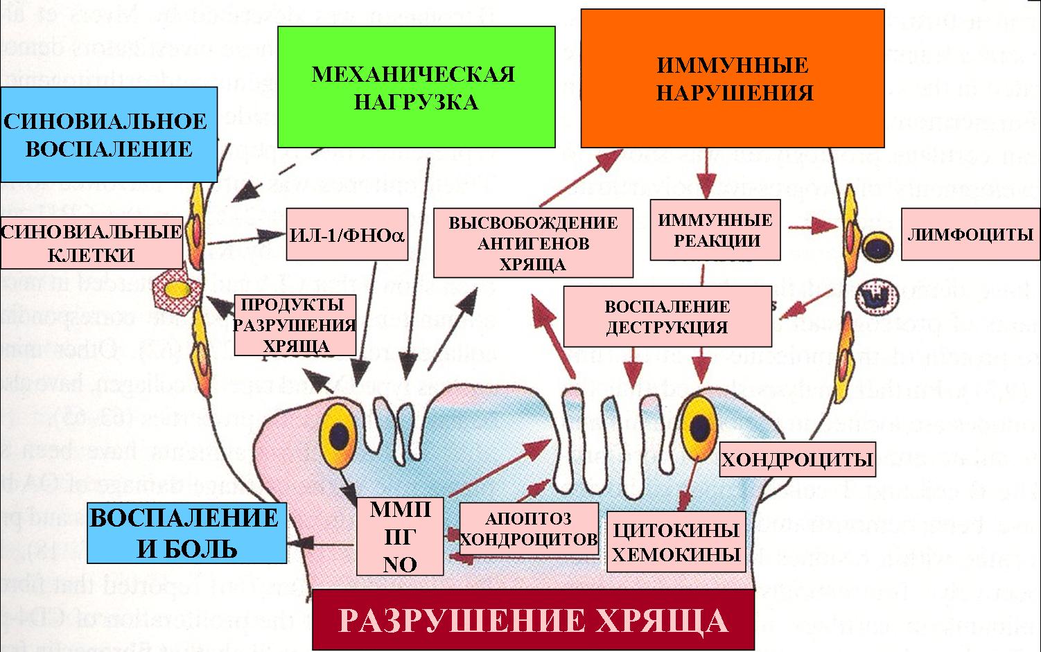 Иммунная нагрузка. Патогенез остеоартрита. Патогенез остеоартроза. Этиология остеоартроза. Патогенез деформирующего остеоартроза.